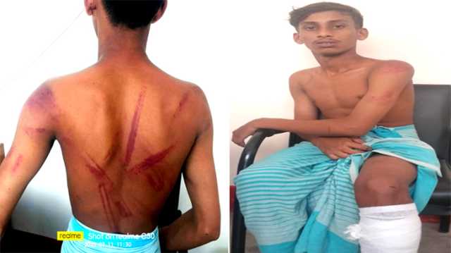 বন্দরে দুই বন্ধুকে কুপিয়ে মোবাইল সেট ও নগদ টাকা লুট  