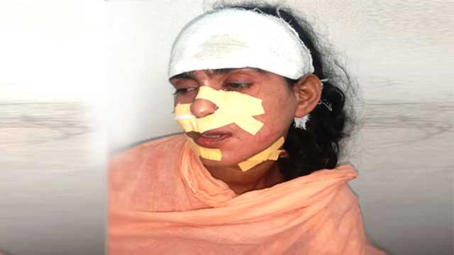 বন্দরে প্রতিপক্ষের সন্ত্রাসী হামলায় বাবা-মেয়ে আহত  