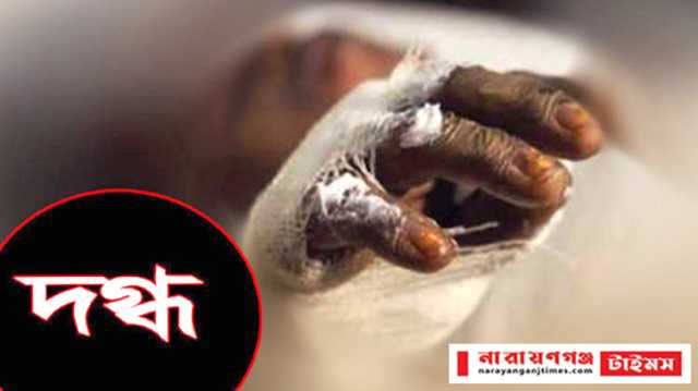 আড়াইহাজারে গ্যাস বিস্ফোরণে ৪ শ্রমিক দগ্ধ