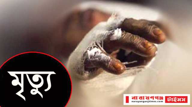ফতুল্লায় অগিকান্ডে প্রতিবন্ধি যুবকের মৃত্যু