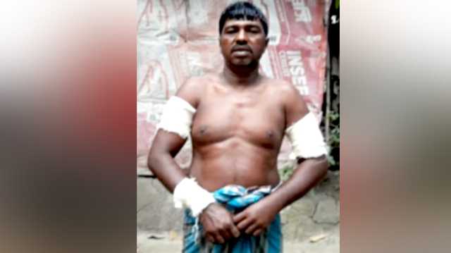 বন্দরে সন্ত্রাসী হামলায় ঝালমুড়ি বিক্রেতা জখম 