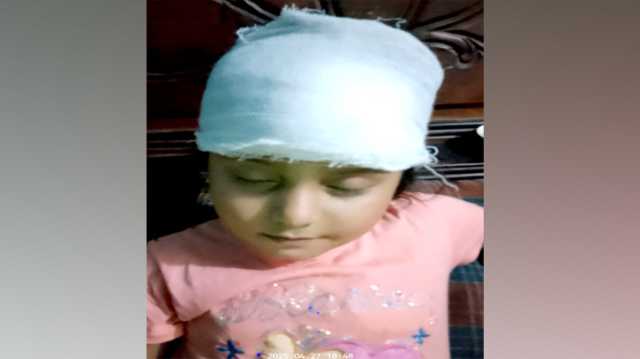 বন্দরে অটো গাড়ি ও মিশুকের মুখোমুখি সংঘর্ষে শিশুসহ আহত ৪ 