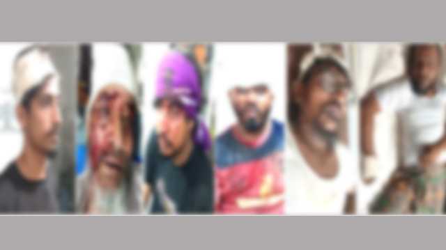 সোনারগাঁয়ে পৃথক দুটি সংঘর্ষে আহত ১৩ 