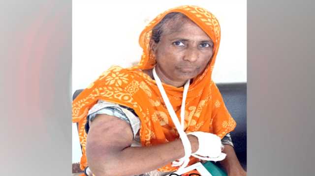 বন্দরে মধ্যবয়সী নারীকে কুপিয়ে জখম  