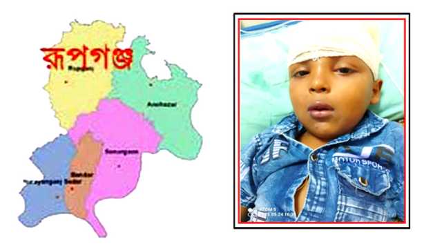 রূপগঞ্জে ৪ বছরের শিশুকে কুপিয়ে জখম
