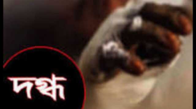 কাঁচপুরে গ্যাস লিকেজ থেকে বিস্ফোরন, শিশুসহ দগ্ধ ৫
