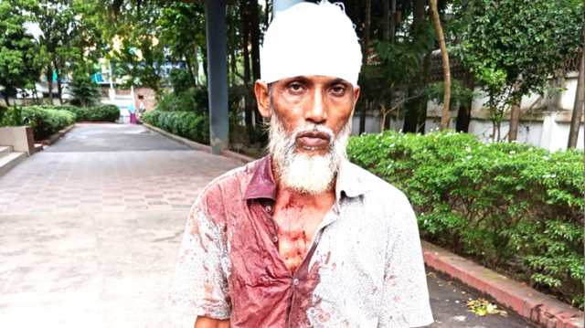 বন্দরে শ্যালকদের সন্ত্রাসী হামলায় জামাতা জখম 