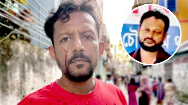 ‎গাবতলীতে মাদক সেবনে বাঁধা দেয়ায়  যুবদল নেতাকে কুপিয়ে জখম ‎ ‎