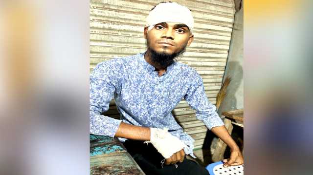 রূপগঞ্জে বাবা-ছেলেকে কুপিয়ে জখম, নগদ টাকা ও স্বর্ণালংকার লুট