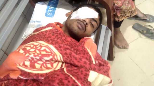 রূপগঞ্জে শিক্ষার্থীকে অপহরণ, মুক্তিপণ না পেয়ে চোখ উপড়ে হত্যা চেষ্টা