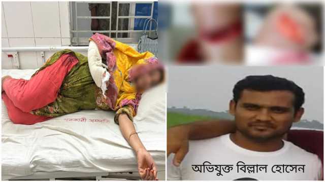  সোনারগাঁয়ে কু-প্রস্তাবের প্রতিবাদ করায় গৃহবধূকে কুপিয়ে হত্যা চেষ্টা 