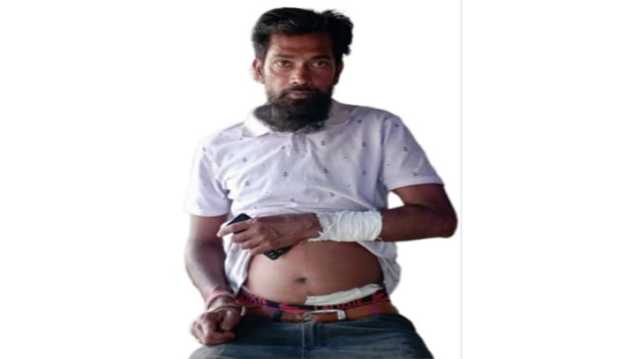 বন্দরে কিশোর গ্যাং’র হামলায় পিতা-পুত্র আহত 