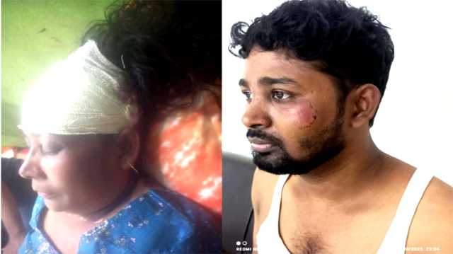 বন্দরে শ^শুড় বাড়ির সন্ত্রাসী হামলায় মা ও ছেলে জখম  
