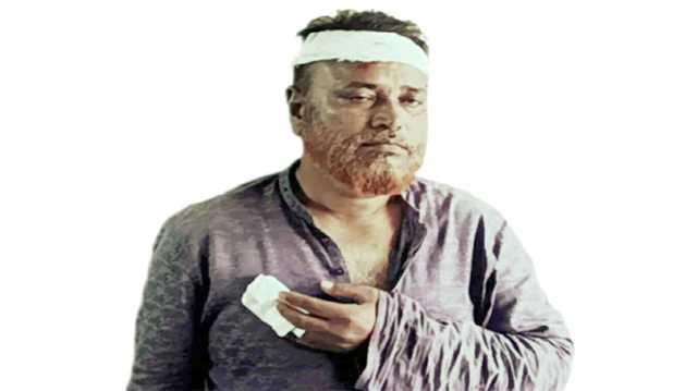 বন্দরে বিএনপি নেতাকে কুপিয়ে জখম করলো জাপা দোসররা