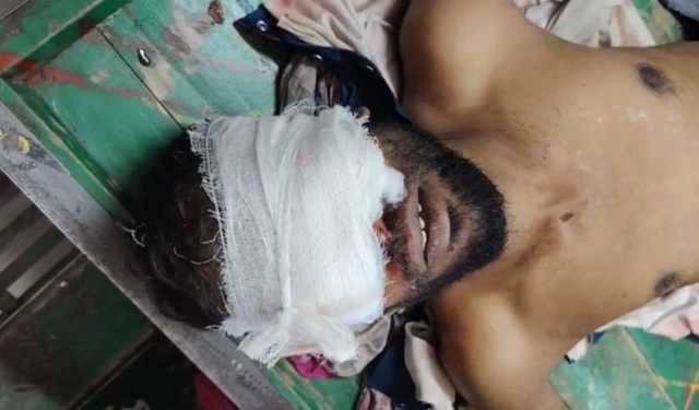 এবার শরীয়তপুরে এক ব্যক্তির চোখ উপড়ে ফেলার অভিযোগ