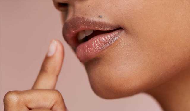 ঠোঁটে কালো দাগ হওয়ার কারণ ও প্রতিকার