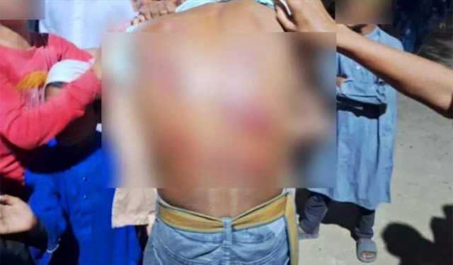 চুরির অপবাদে এতিমখানার শিশুকে খুঁটিতে বেঁধে নির্যাতন, আটক ১