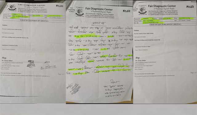 হাতভাঙার ভুয়া এক্স-রে জমা দিয়ে মামলার অভিযোগ 