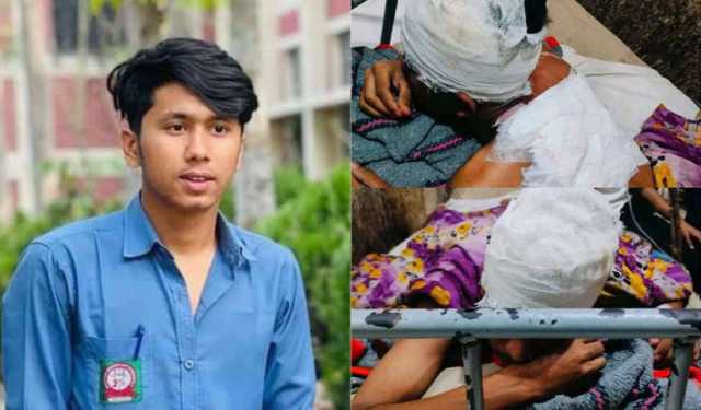 শহীদ রিজভীর ভাই রিমনের ওপর হামলা, ছাত্র ইউনিয়নের নিন্দা