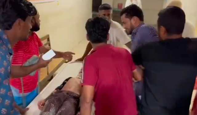 শ্বাসনালিতে আতশবাজির আগুন, মুহূর্তে প্রাণ গেল শিশুর