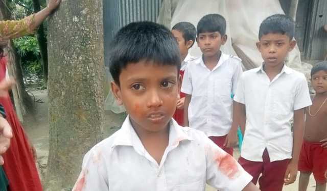 তুচ্ছ ঘটনায় শিক্ষার্থীর নাক ফাটালেন সহকারী শিক্ষক 