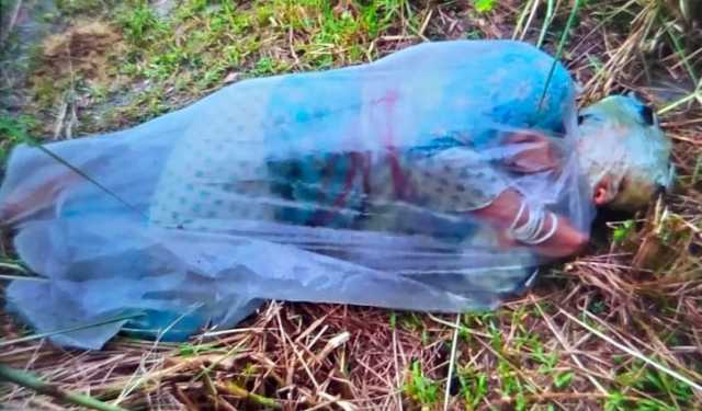 বরিশালে পলিথিনে মোড়ানো এসিডদগ্ধ নারীকে জীবিত উদ্ধার