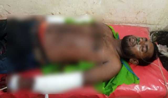 চাচাতো ভাইয়ের বিরুদ্ধে কুপিয়ে হাত বিচ্ছিন্নের অভিযোগ