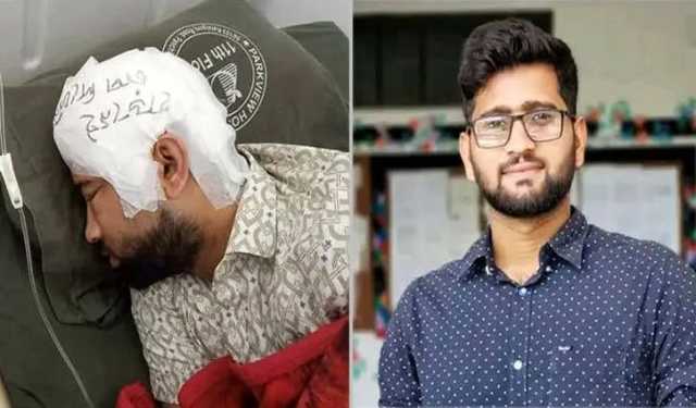 দুই মাস ফ্রিজে রাখার পর মামুনের মাথায় খুলি পুনঃস্থাপন