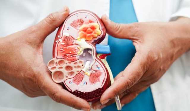 ইউরিক অ্যাসিড নিয়ন্ত্রণে করণীয়