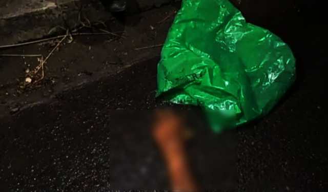 নাটোরে পলিথিনে মোড়ানো মানুষের হাত উদ্ধার