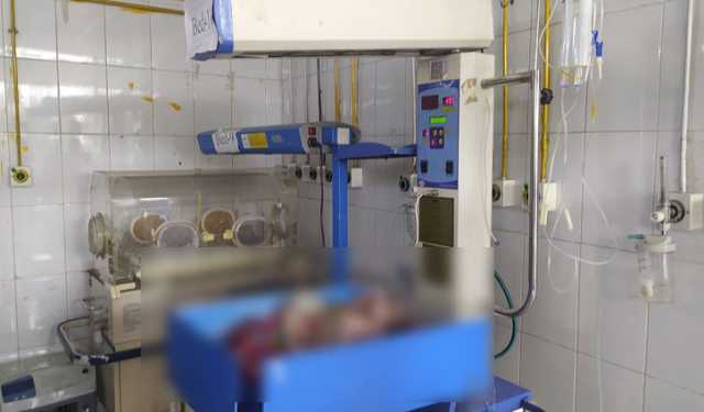 দুই মাথা নিয়ে জন্মানো শিশুর ২ ঘণ্টার পর মৃত্যু