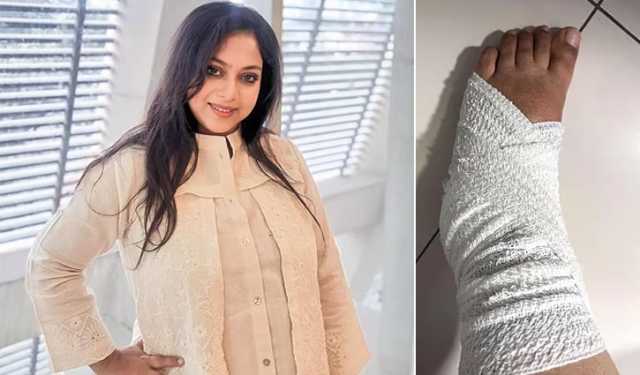 হোঁচট খেয়ে শাবনূরের পায়ে প্লাস্টার, বললেন— ‘আক্কেল হইছে!’