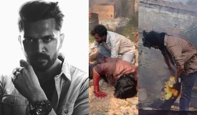 শুটিং সেটে আগুনে দগ্ধ আরিফিন শুভ