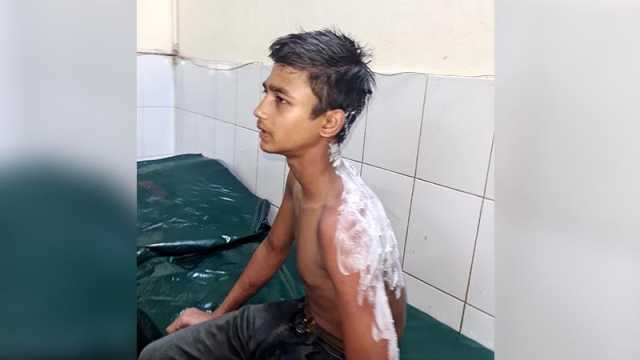 হোটেল কর্মচারীর গায়ে ভাতের গরম মাড় ঢেলে দেওয়ার অভিযোগ