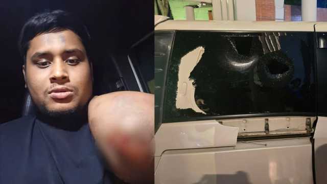 ৪-৫টি মোটরসাইকেলে এসে হাসনাতের গাড়িতে হামলা: পুলিশ