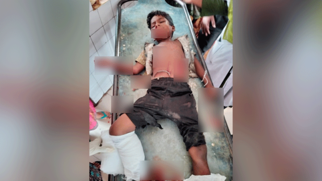 যশোরে ‘কুড়িয়ে পাওয়া’ ককটেল বিস্ফোরণে ১ শিশু নিহত, আহত ২