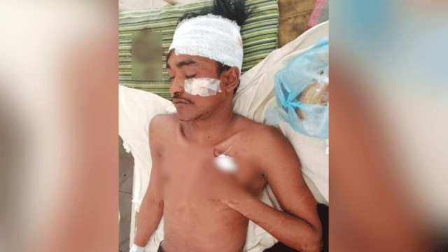 দাখিল পরীক্ষা দিয়ে বাড়ি ফিরছিল, ২০-২৫ জন এসে পিটিয়ে ও কুপিয়ে জখম করল রাব্বিকে