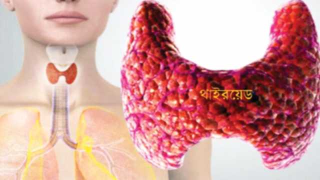 থাইরয়েডজনিত সমস্যা