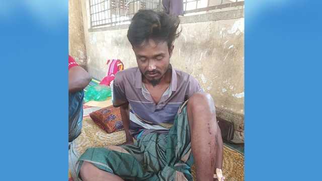 সুন্দরবনে কাঁকড়া ধরতে গিয়ে জেলে গুলিবিদ্ধ