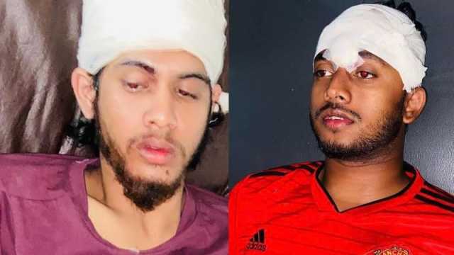 গভীর রাতে বৈষম্যবিরোধীর দুই কর্মীকে কোপাল ছাত্রলীগ