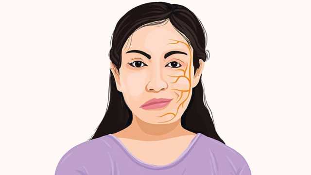 এই সময় হঠাৎ মুখ বেঁকে যায় কেন? কিছু পরামর্শ